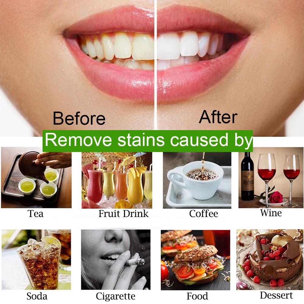 30 גרם הלבנת שיניים טיפולי פה אבקת פחם טבעי צמח השיניים צמח הלבנת אבקת היגיינת הפה הסר כתמים